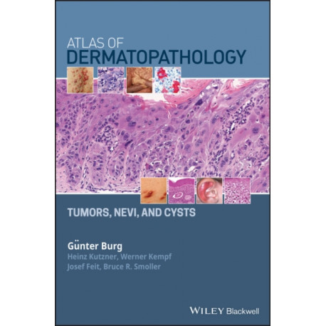Atlas of Dermatopathology: Tumors, Nevi, and Cysts