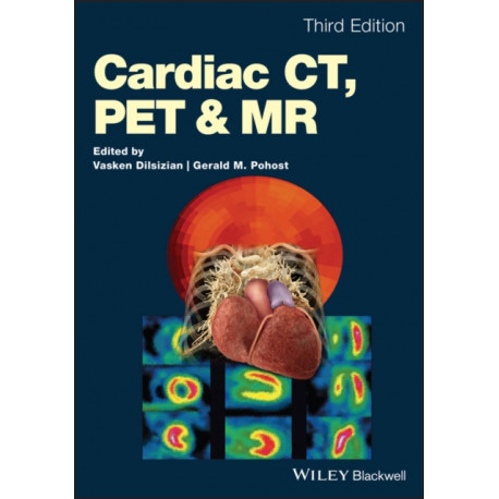 Cardiac CT, PET and MR