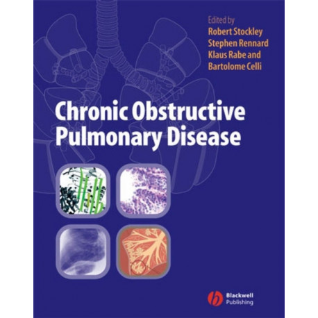 Chronic Obstructive Pulmonary Disease