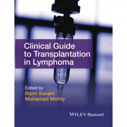 Clinical Guide to Transplantation in Lymphoma