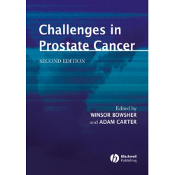 Challenges in Prostate Cancer
