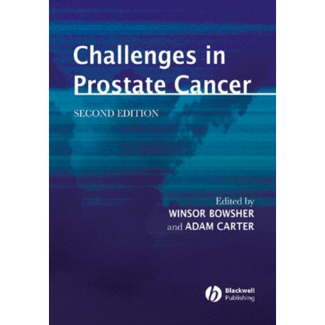 Challenges in Prostate Cancer