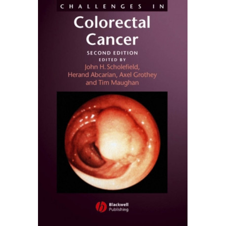 Challenges in Colorectal Cancer