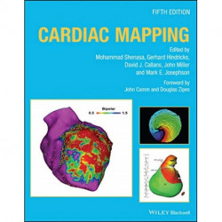 Cardiac Mapping