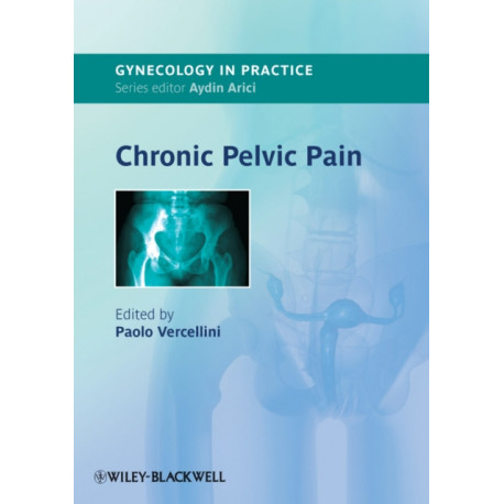 Chronic Pelvic Pain