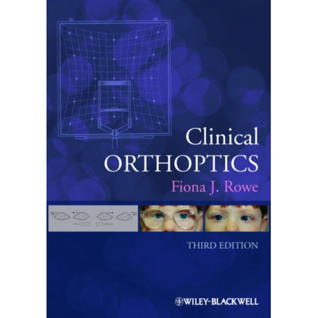 Clinical Orthoptics