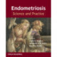 Endometriosis: Science and Practice