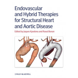 Endovascular and Hybrid Therapies for Structural Heart and Aortic Disease