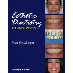 Esthetic Dentistry in Clinical Practice