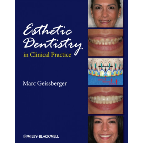 Esthetic Dentistry in Clinical Practice