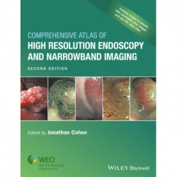 Comprehensive Atlas of High-Resolution Endoscopy and Narrowband Imaging