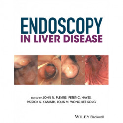 Endoscopy in Liver Disease