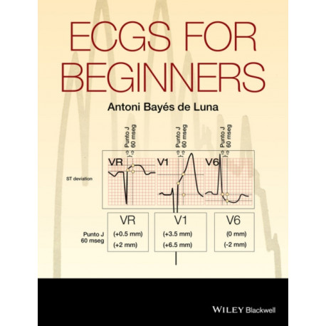 ECGs for Beginners