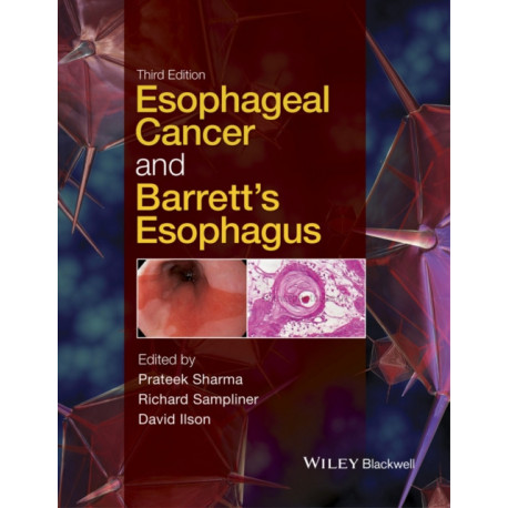 Esophageal Cancer and Barrett's Esophagus