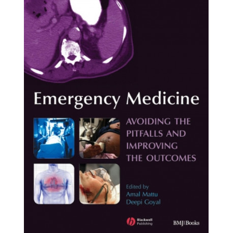 Emergency Medicine: Avoiding the Pitfalls and Improving the Outcomes