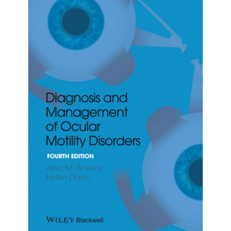 Diagnosis and Management of Ocular Motility Disorders