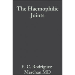 The Haemophilic Joints: New Perspectives