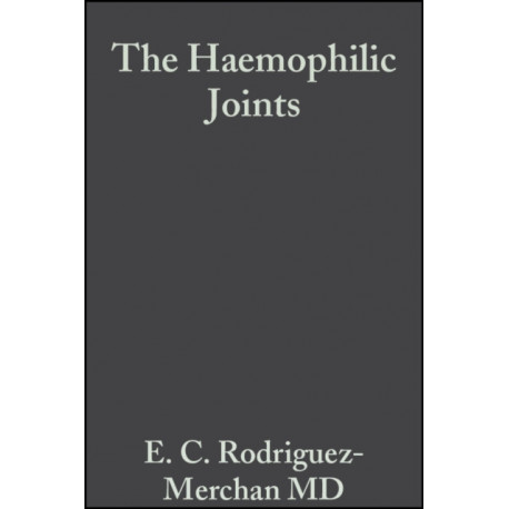 The Haemophilic Joints: New Perspectives