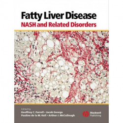 Fatty Liver Disease: NASH and Related Disorders