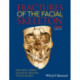 Fractures of the Facial Skeleton