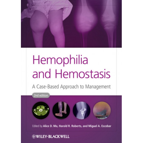 Hemophilia and Hemostasis: A Case-Based Approach to Management