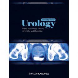 Handbook of Urology