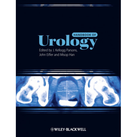Handbook of Urology