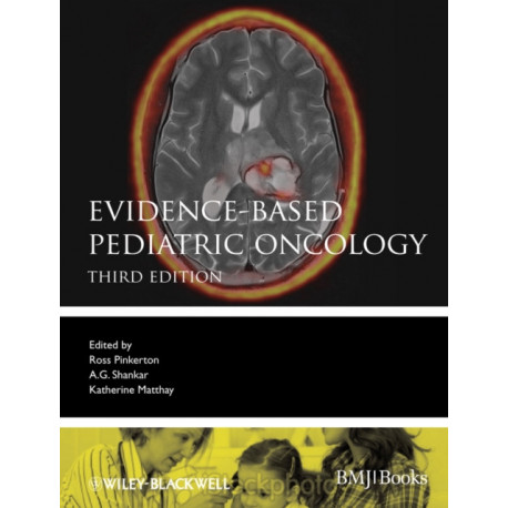 Evidence-Based Pediatric Oncology
