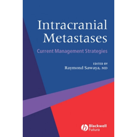Intracranial Metastases: Current Management Strategies