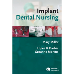Implant Dental Nursing