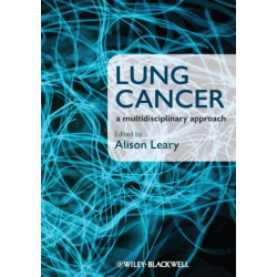 Lung Cancer: A Multidisciplinary Approach