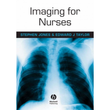 Imaging for Nurses