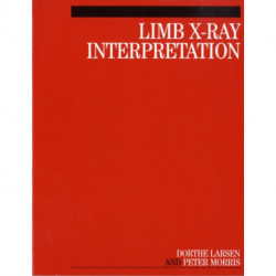 Limb X-Ray Interpretation