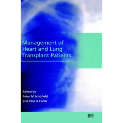 Management of Heart and Lung Transplant Patients