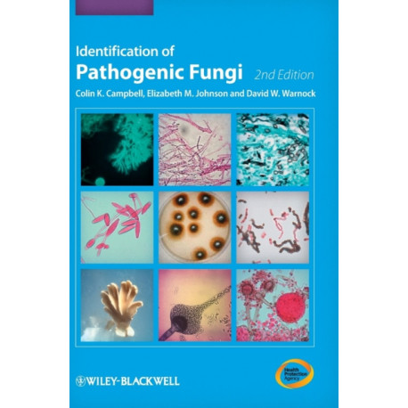 Identification of Pathogenic Fungi