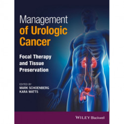 Management of Urologic Cancer: Focal Therapy and Tissue Preservation