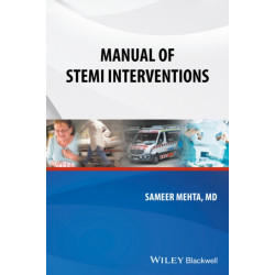 Manual of STEMI Interventions