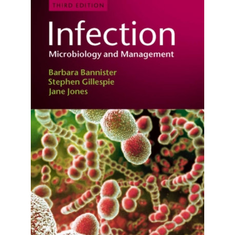 Infection: Microbiology and Management