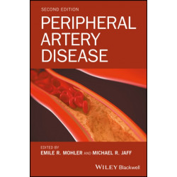 Peripheral Artery Disease