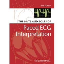 The Nuts and bolts of Paced ECG Interpretation