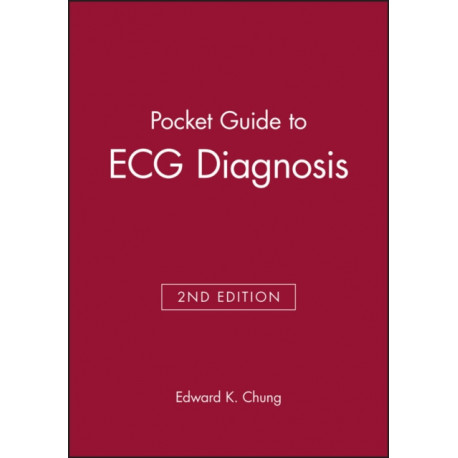 Pocket Guide to ECG Diagnosis