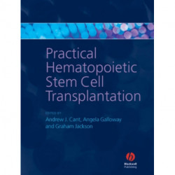 Practical Hematopoietic Stem Cell Transplantation