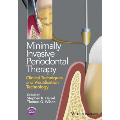 Minimally Invasive Periodontal Therapy: Clinical Techniques and Visualization Technology