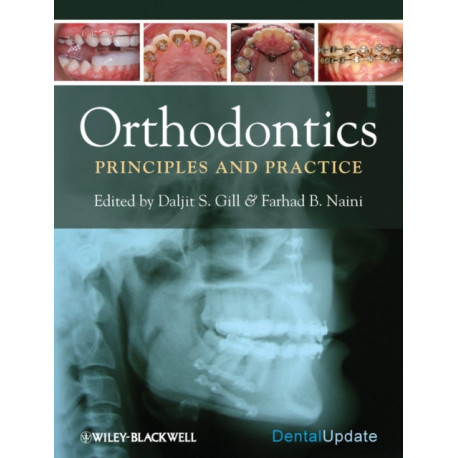 Orthodontics: Principles and Practice