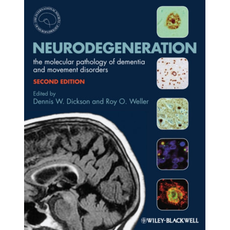 Neurodegeneration: The Molecular Pathology of Dementia and Movement Disorders