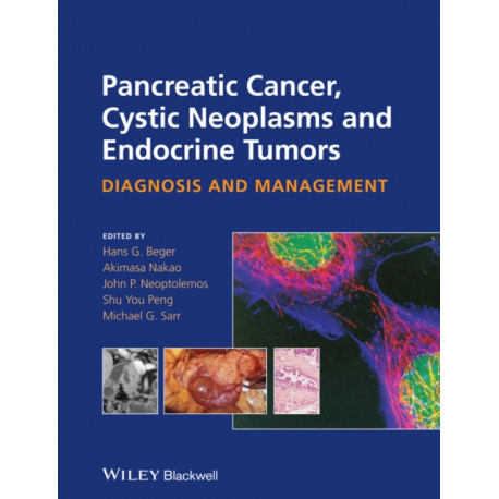 Pancreatic Cancer, Cystic Neoplasms and Endocrine Tumors: Diagnosis and Management