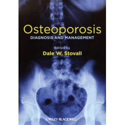 Osteoporosis: Diagnosis and Management