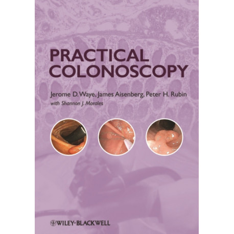 Practical Colonoscopy