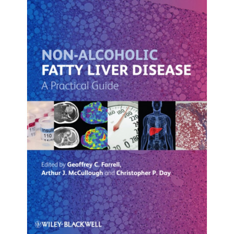 Non-Alcoholic Fatty Liver Disease: A Practical Guide
