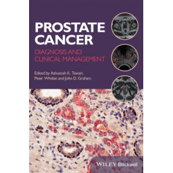 Prostate Cancer: Diagnosis and Clinical Management